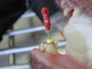 tratamento de canal 300x225 - Odontologia