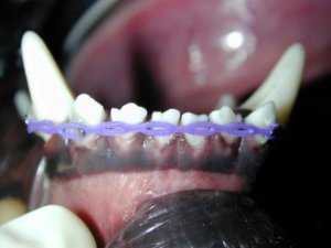 tratamento ortodontico 300x225 - Odontologia